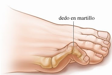El medio público del hongo y el moho sobre la madera